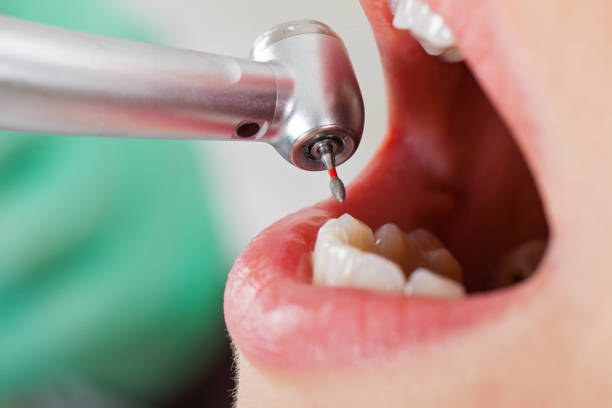 Best Emergency Dental Care for Trauma or Injury in Fairfield Plantation, GA